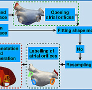 Überblick über das standardisierte Verfahren zur Erstellung personalisierter Computermodelle des Vorhofs aus verschiedenen klinischen anatomischen und funktionellen Daten. (Bild: Institut für Biomedizinische Technik / KIT) 