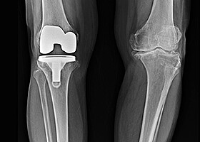 750 - Funktionalisierung von Parylenoberflächen mit UV