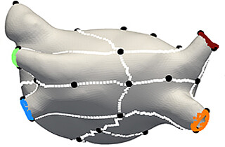 Heart models for the treatment of atrial fibrillation 
