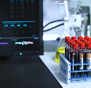 Until now, blood and urine samples have mainly been analyzed in specialized laboratories at great expense. The new sensors, on the other hand, can be analyzed using simple spectroscopic measuring devices. The aim is to improve the early detection of diseases through the widespread use of molecular diagnostics in medical practices and hospitals as well as in pharmacies. (Image: Synthex / Adobe Stock)